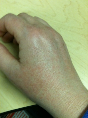 Downside to Sunshine