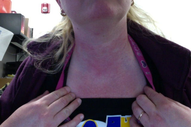 Downside to Sunshine, Part 2